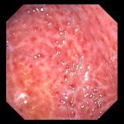 ����������θ�׸���������